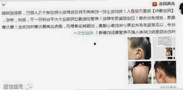 详细解析：91禁🍆🍑🔞❌❌❌看片17c官方版免费版及相关资源推荐